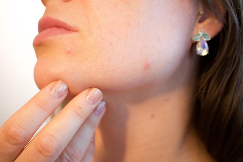Effective Ways to Eliminate Large Pores